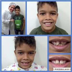 Comparison of a patient's teeth before and after dental surgery