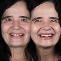 Comparison of a patient's teeth before and after dental surgery
