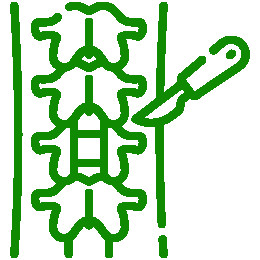 Spinal Surgery